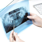 dentist examines x ray photo of teeths