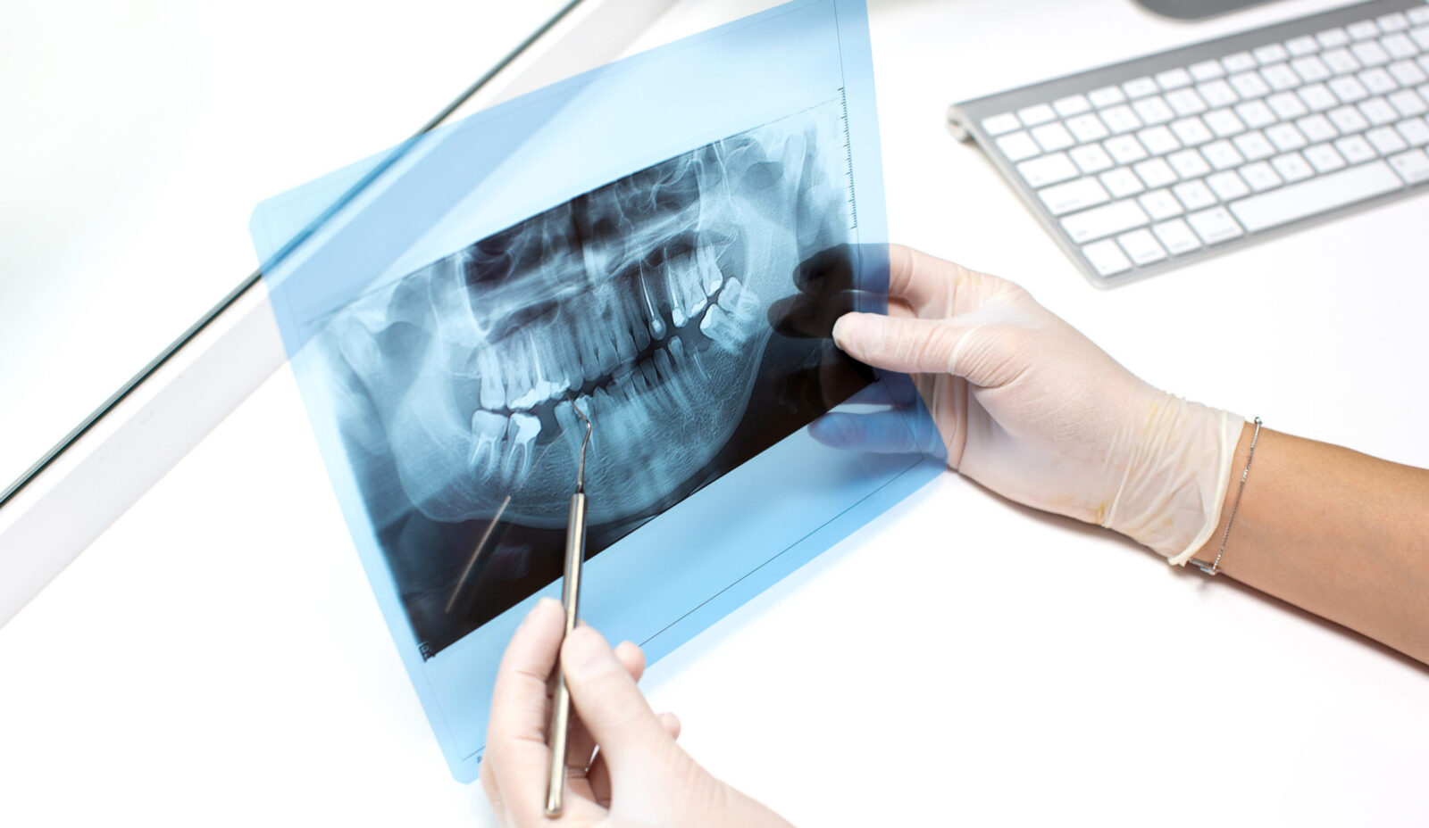 dentist examines x ray photo of teeths