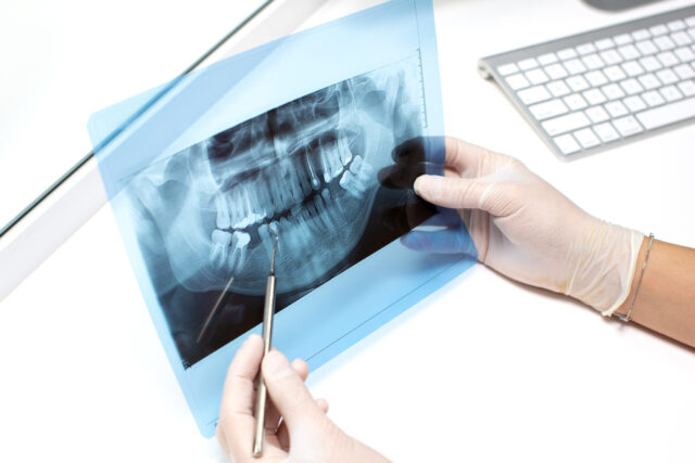 dentist examines x ray photo of teeths